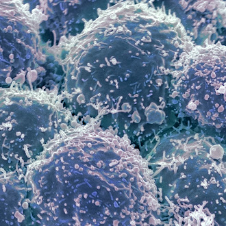 Oncologos destacan diagnostico temprano como factor clave